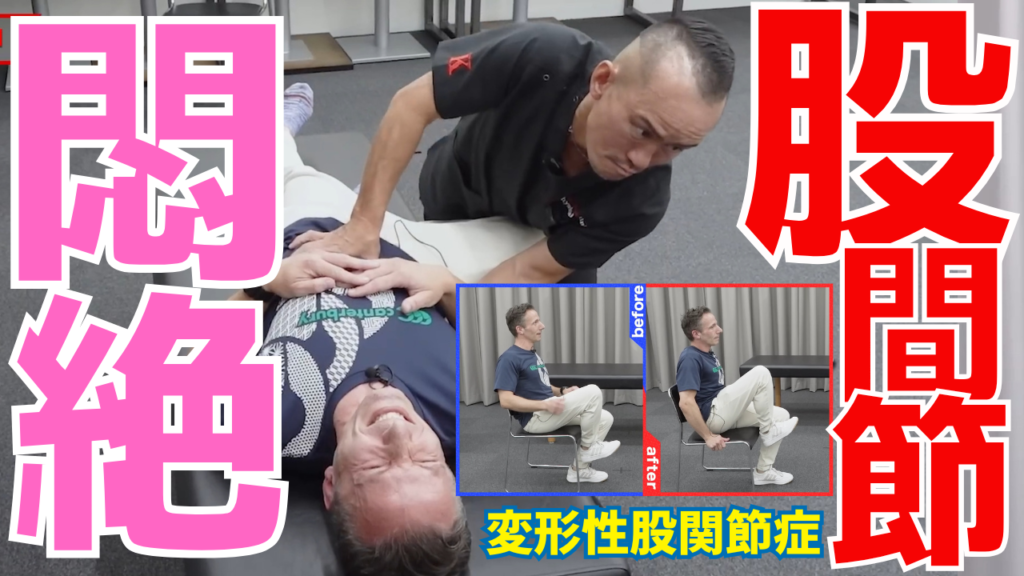 【神経系ストレッチ】長崎県長崎市から来院｜5年前から続いた左股関節痛が改善！