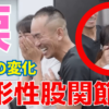 【神経系ストレッチ】変形性股関節症による歩行時の痛みが改善！福岡県筑紫野市からの来院事例（SSS兼子ただし技術指導）