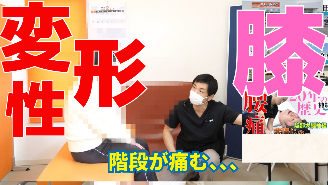 神経系ストレッチとは？正式には「神経モビライゼーション（Neural