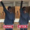 肩が上がらない胸郭出口症候群｜兼子ただし神経系ストレッチで改善解消！｜熊本県菊池市からも来院の神経整体