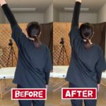 肩が上がらない胸郭出口症候群｜兼子ただし神経系ストレッチで改善解消！｜熊本県菊池市からも来院の神経整体