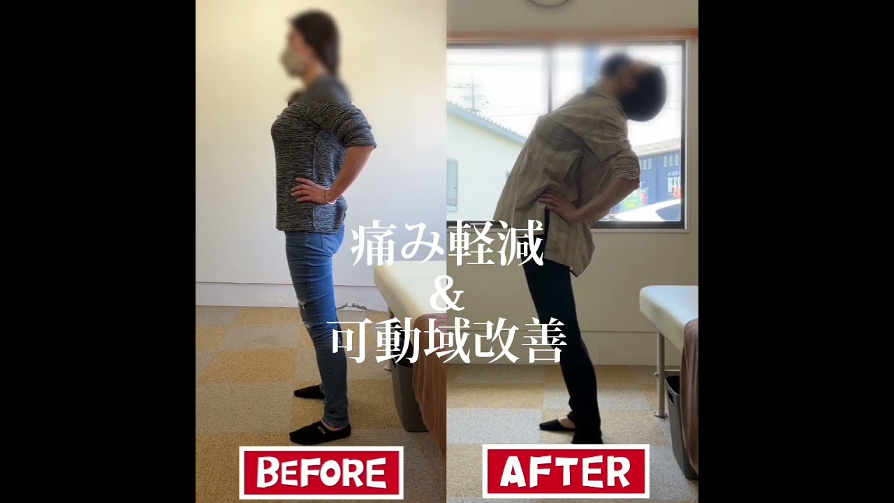 腕を上げると痛む胸郭出口症候群|兼子ただし神経系ストレッチで改善解消!|大分県由布市からも来院の神経整体