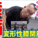変形性膝関節症での膝痛｜兼子ただし神経系ストレッチで改善解消！｜大分県日田市からも来院の神経整体