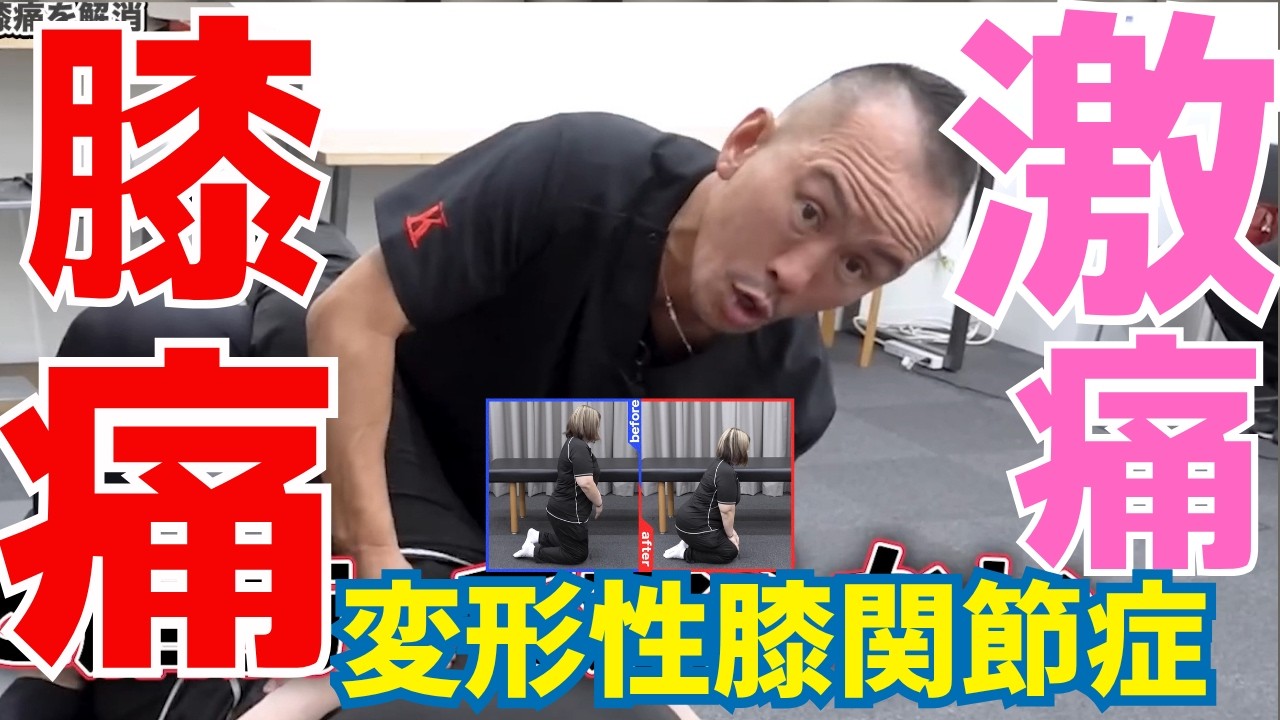変形性膝関節症での膝痛｜兼子ただし神経系ストレッチで改善解消！｜大分県日田市からも来院の神経整体