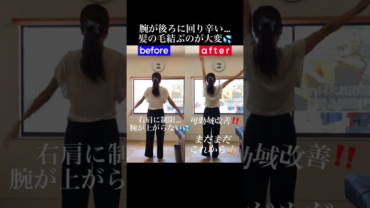 日常生活に支障をきたす四十肩｜兼子ただし神経系ストレッチで改善解消！｜福岡県飯塚市からも来院の神経整体