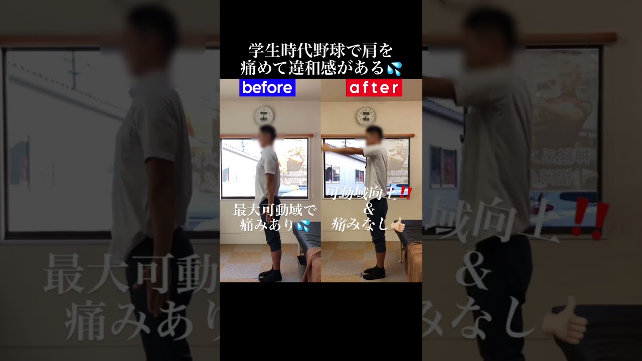 野球後に残る肩の違和感|兼子ただし神経系ストレッチで改善解消!|福岡県うきは市からも来院の神経整体