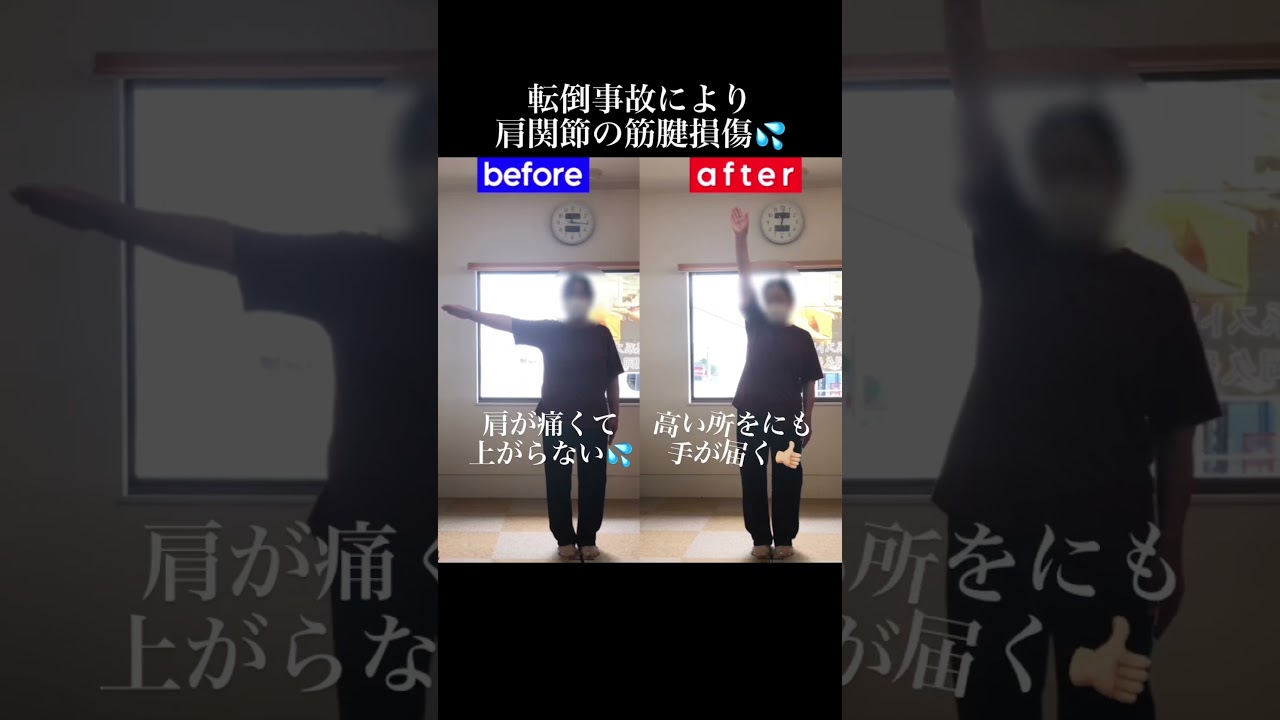 腕を上げようとすると痛む肩関節痛|兼子ただし神経系ストレッチで改善解消!|福岡県柳川市からも来院の神経整体