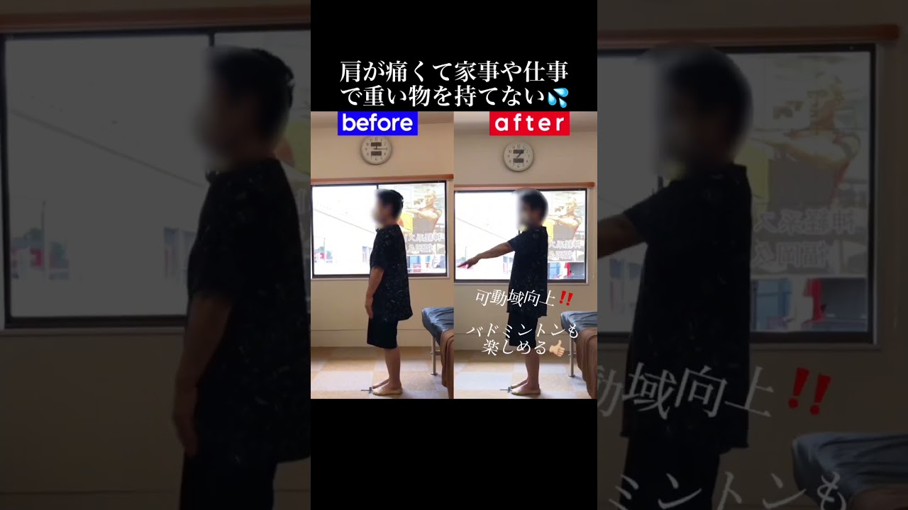 日常生活に困る肩の痛み|兼子ただし神経系ストレッチで改善解消!|福岡県川崎町からも来院の神経整体