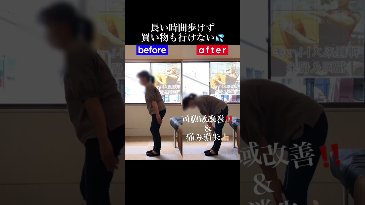 歩くと足が重くなる脊柱管狭窄症｜兼子ただし神経系ストレッチで改善解消！｜福岡県嘉麻市からも来院の神経整体