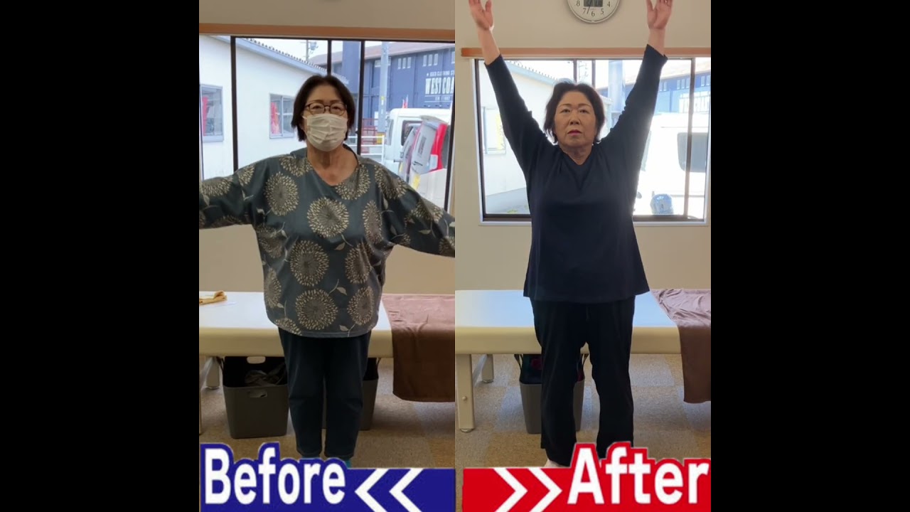 腱板断裂で腕が上がらない肩の痛み|兼子ただし神経系ストレッチで改善解消!|福岡県添田町からも来院の神経整体