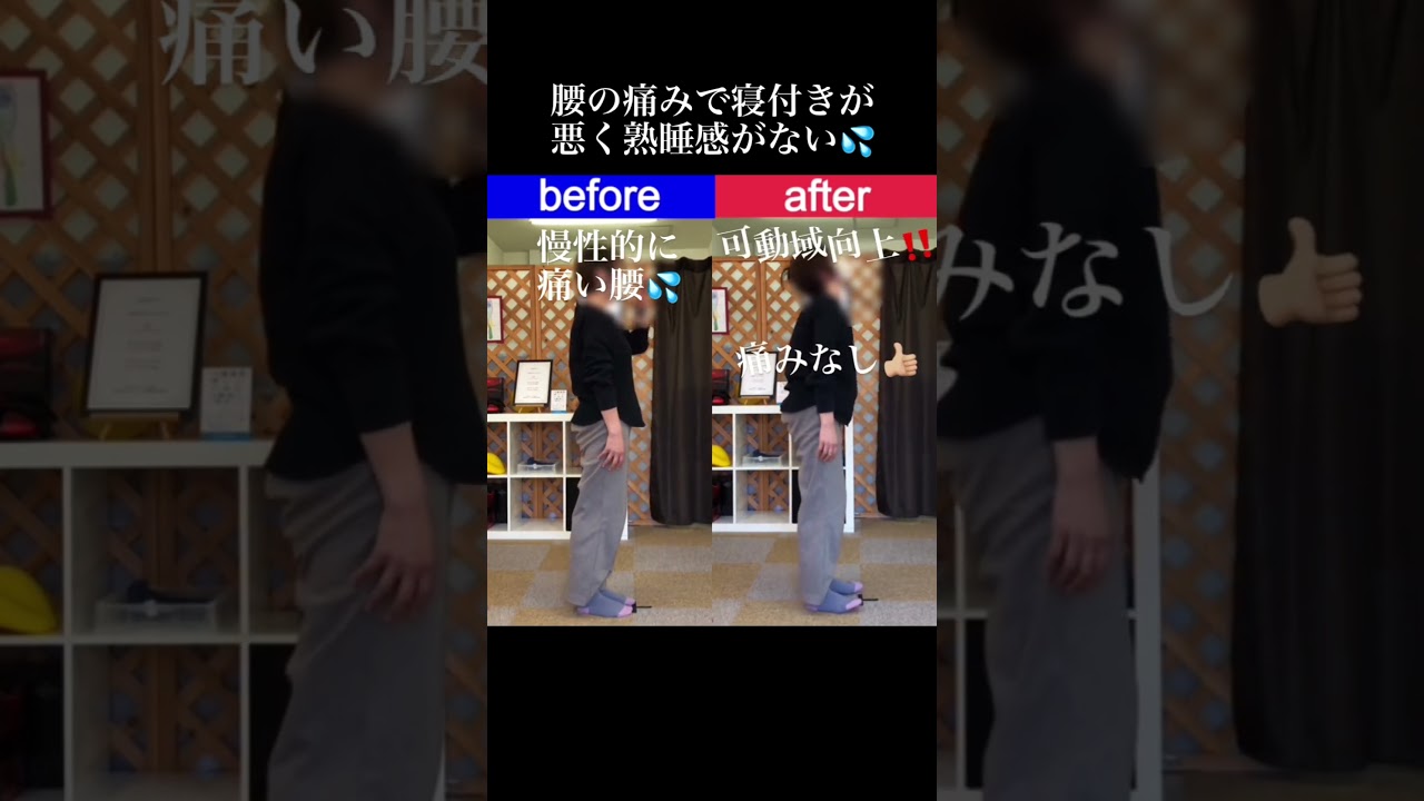 長年抱える慢性腰痛|兼子ただし神経系ストレッチで改善解消!|大分県由布市からも来院の神経整体