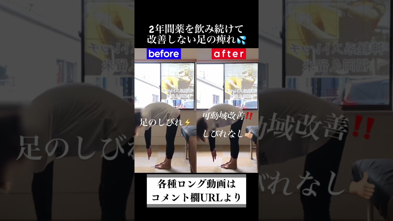 急に出て動けない坐骨神経痛|兼子ただし神経系ストレッチで改善解消!|熊本県菊池市からも来院の神経整体